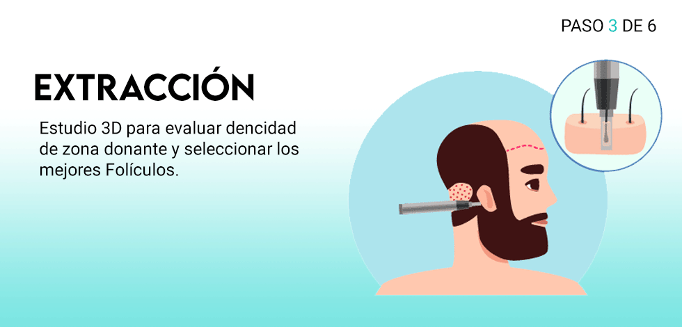 tecnica_3_de_6_a